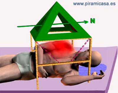 Tratamiento antipiramidal hombro