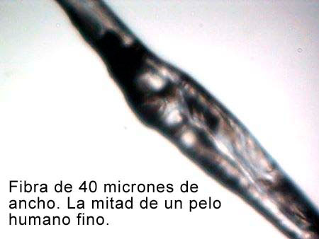 Fibra relacionada con morgellons